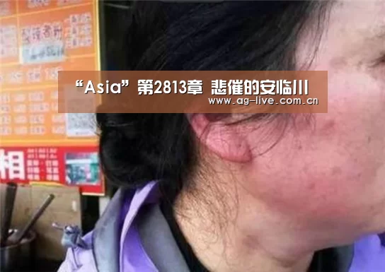 “Asia”第2813章 悲催的安临川(图2) “Asia”第2813章 悲催的安临川(图2)